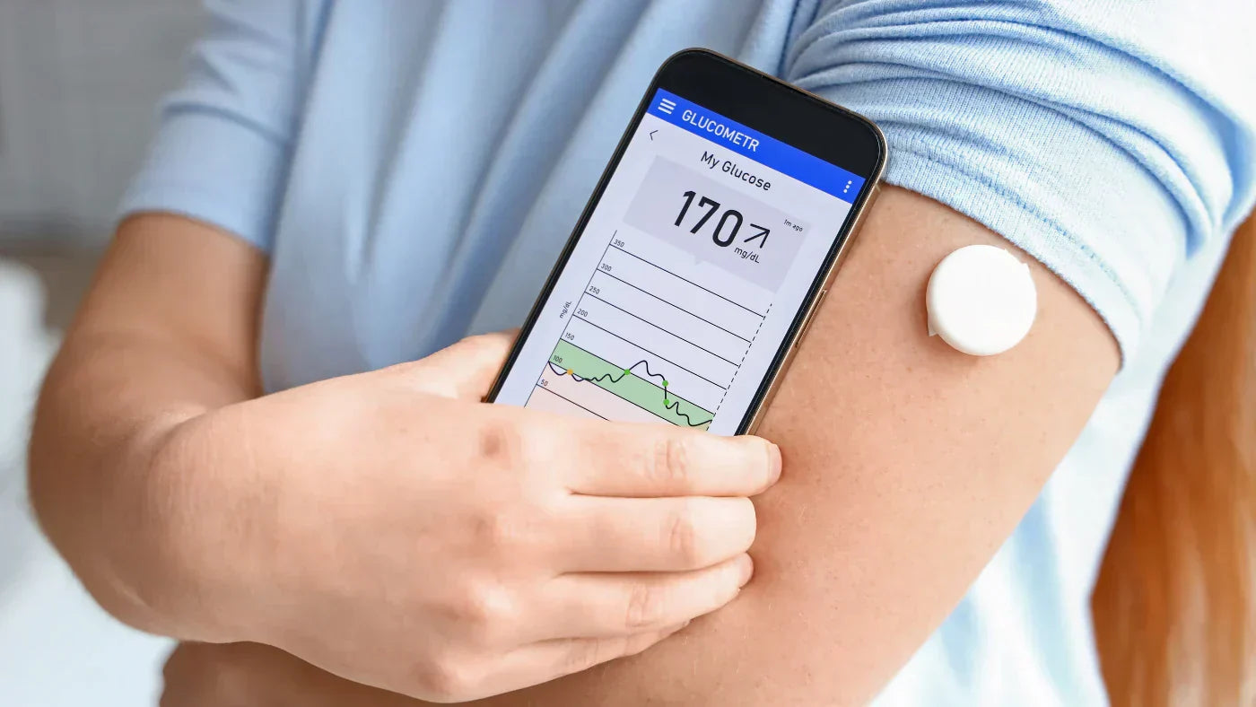 Surveillance du taux de glucose pendant 15 jours : 5 conclusions d’une nutritionniste